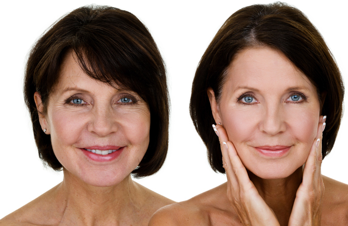 Anti-aging arckezelések - Hámori Betti kozmetikus weboldala - Óbuda